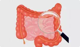 Przyspiesza proces oczyszczania organizmu
