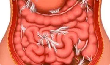 Niszczenie narządów